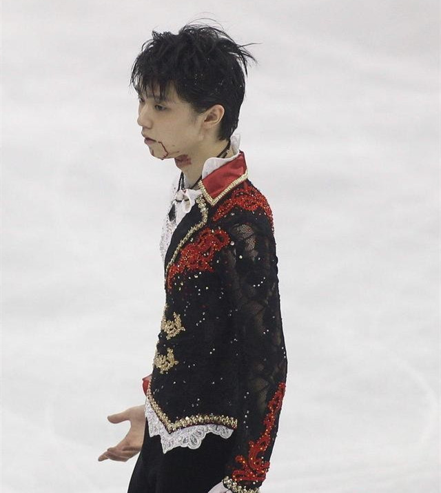 羽生結弦