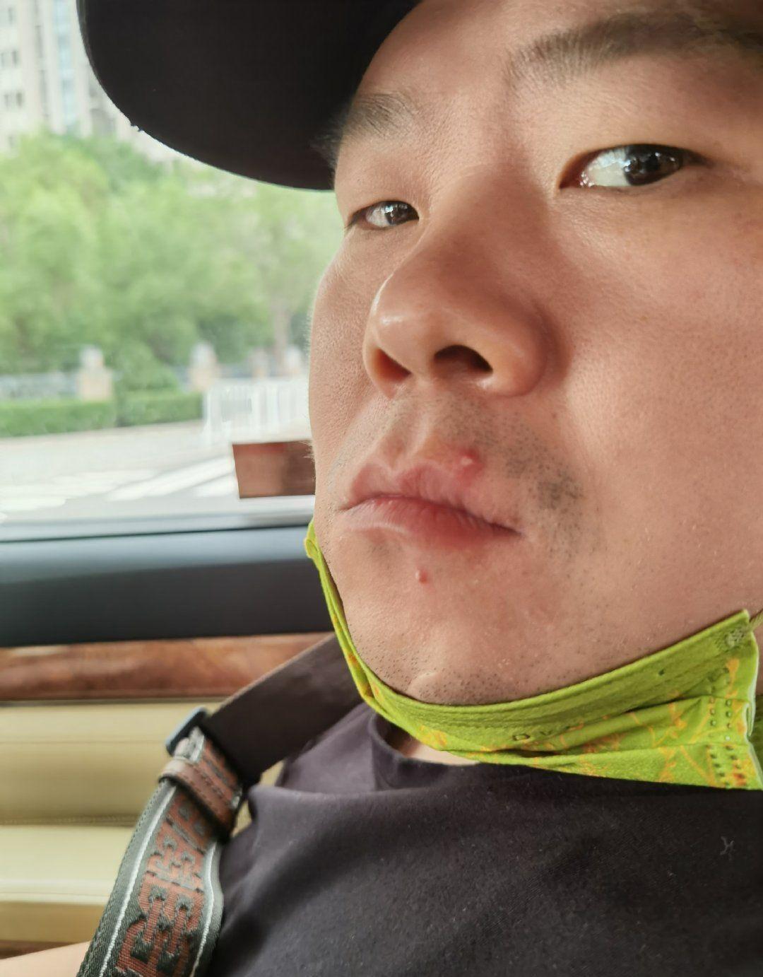 鄭敏曬岳雲鵬懟臉照，調侃老公長青春痘，小岳岳鬍子拉碴一臉冷漠