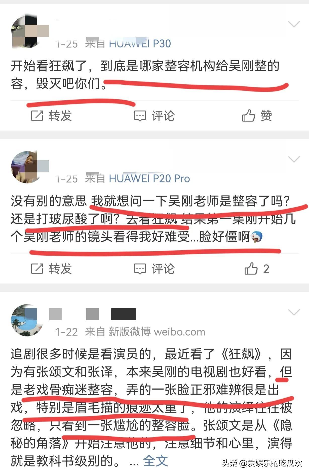 吳剛整容終於真相大白，原來臉腫不是因為打了玻尿酸，而是太敬業